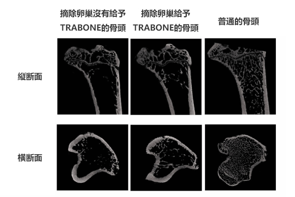 美骨肌含有預防骨密度低下的TRABONE