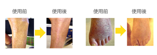 使用舞潤特級保濕霜對幹燥肌膚的改善效果