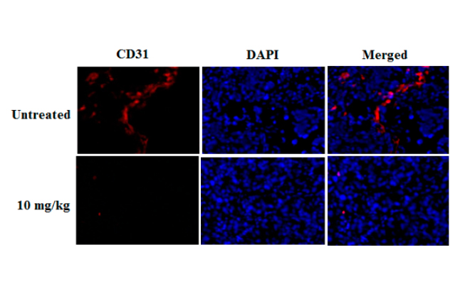 Potential of Pigment from Saw Palmetto for Adjuvant Therapy of Hepatocellular Carcinoma