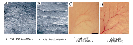 紫外綫照射引起小鼠皮膚產生皺紋以及形成血管生成血管新生和皮膚疾病