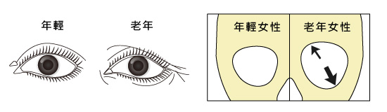 皺紋與骨密度的關係