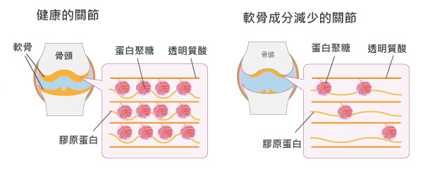 關節軟骨的蛋白聚糖