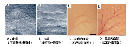 Ultra maco: 血管新生和皺紋的關聯