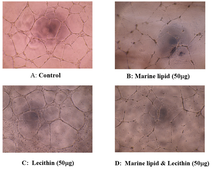 Synergistic effect on anti-angiogenesis by a mixture of Marine Lipid with lecithin