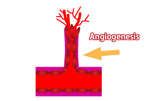 angiogenesis04