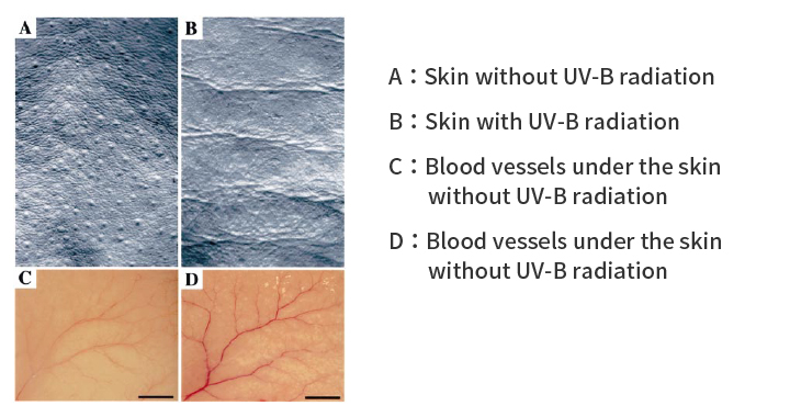 Relationship of Angiogenesis and Wrinkles in skin