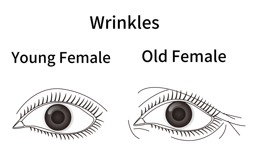 Connection between bone and skin