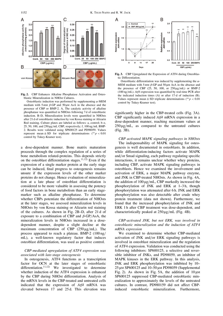 CBP Facilitate Osteogenesis through Activation of the JNK-ATF4 Pathway P3