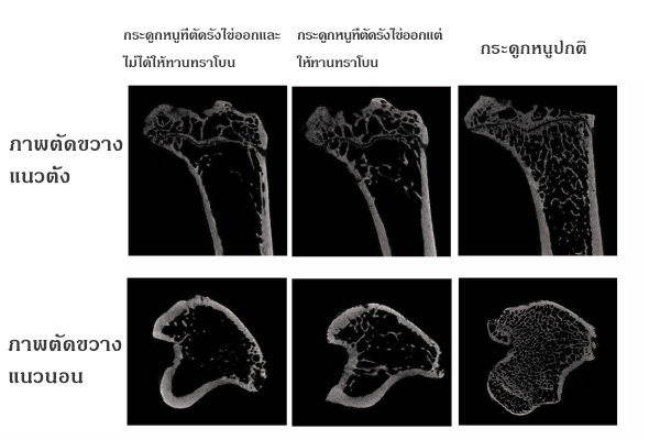 บิโคกกิ(Bikokki): การทำหน้าที่ช่วยยับยั้งการลดลงของกระดูกฟองน้ำของทราโบน