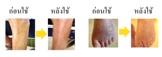 ประสิทธิผลการปรับปรุงสภาพผิวแห้งจากการใช้ครีมไมจุน