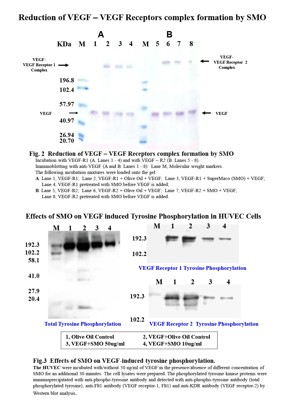 An ethanolic extract from a shark having potent anti-angiogeneric activity P5