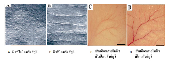 การเกิดริ้วรอยบนผิวหนังของหนูจากการโดนรังสียูวีและรูปร่างของเส้นเลือดงอกใหม่