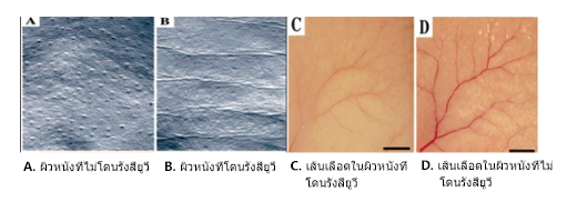 อัลตร้ามาโกะ (Ultra maco): การเกิดริ้วรอยและการก่อตัวของเส้นเลือดฝอยงอกใหม่ในผิวหนังของหนูที่โดนรังสียูวี